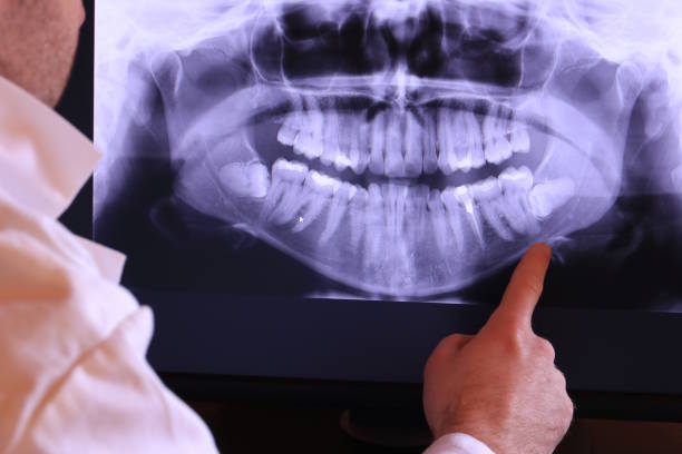 Best Tooth Infection Emergency Dentist  in Wellington, TX
