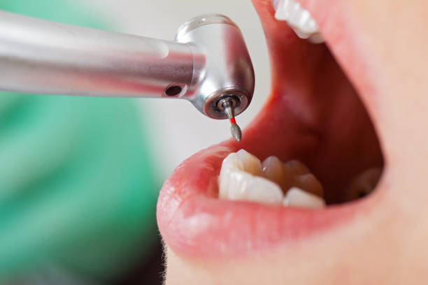 Best Emergency Gum Pain Relief  in Wellington, TX